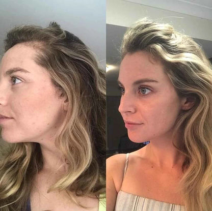 Cápsulas con Biotina para Crecimiento Capilar y de Uñas